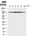 NLR Family Pyrin Domain Containing 2 antibody, NB100-56154, Novus Biologicals, Western Blot image 