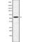 Activin A Receptor Type 2B antibody, abx147963, Abbexa, Western Blot image 