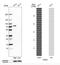 Peptidyl Arginine Deiminase 3 antibody, NBP1-92240, Novus Biologicals, Western Blot image 