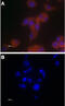 Transient receptor potential cation channel subfamily V member 6 antibody, GTX54869, GeneTex, Immunocytochemistry image 