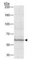 Bestrophin 1 antibody, GTX30219, GeneTex, Western Blot image 