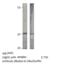 Tumor Protein D52 antibody, MBS540126, MyBioSource, Western Blot image 