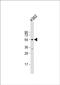 Hyaluronidase 4 antibody, PA5-48622, Invitrogen Antibodies, Western Blot image 