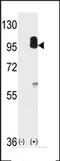 Protein Kinase CGMP-Dependent 2 antibody, 63-330, ProSci, Western Blot image 