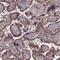 MYC Binding Protein antibody, PA5-59476, Invitrogen Antibodies, Immunohistochemistry paraffin image 
