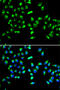 Polypeptide N-Acetylgalactosaminyltransferase 2 antibody, 22-548, ProSci, Immunofluorescence image 