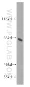 HAUS Augmin Like Complex Subunit 3 antibody, 18991-1-AP, Proteintech Group, Western Blot image 
