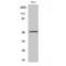 Cholinergic Receptor Nicotinic Alpha 10 Subunit antibody, LS-C381867, Lifespan Biosciences, Western Blot image 