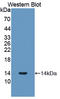 Procollagen-Lysine,2-Oxoglutarate 5-Dioxygenase 3 antibody, LS-C703961, Lifespan Biosciences, Western Blot image 