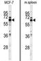 Pantothenate kinase 1 antibody, AP13802PU-N, Origene, Western Blot image 