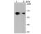 Aldehyde Dehydrogenase 4 Family Member A1 antibody, NBP2-75401, Novus Biologicals, Western Blot image 