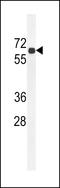 Beta-Carotene Oxygenase 2 antibody, LS-C156764, Lifespan Biosciences, Western Blot image 