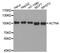 Actinin Alpha 4 antibody, MBS128903, MyBioSource, Western Blot image 