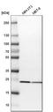 Superoxide Dismutase 2 antibody, HPA001814, Atlas Antibodies, Western Blot image 