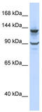 PiggyBac Transposable Element Derived 1 antibody, TA341417, Origene, Western Blot image 