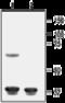 Potassium Voltage-Gated Channel Subfamily J Member 8 antibody, GTX54833, GeneTex, Western Blot image 