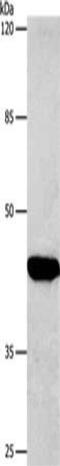 Cellular Communication Network Factor 2 antibody, CSB-PA060417, Cusabio, Western Blot image 