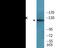 Protein Tyrosine Kinase 2 antibody, EKC2406, Boster Biological Technology, Western Blot image 