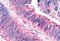 Cadherin EGF LAG Seven-Pass G-Type Receptor 3 antibody, MBS243821, MyBioSource, Immunohistochemistry frozen image 