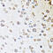 Serpin Family A Member 10 antibody, 22-703, ProSci, Immunohistochemistry paraffin image 