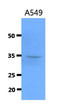 Cathepsin S antibody, LS-C200847, Lifespan Biosciences, Western Blot image 