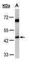 Medium-chain specific acyl-CoA dehydrogenase, mitochondrial antibody, GTX100032, GeneTex, Western Blot image 