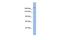 Bromodomain adjacent to zinc finger domain protein 1A antibody, PA5-40610, Invitrogen Antibodies, Western Blot image 