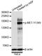 MET antibody, STJ22291, St John