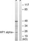 Chromobox protein homolog 5 antibody, TA312347, Origene, Western Blot image 