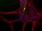 Neurofilament Light antibody, PA3-16719, Invitrogen Antibodies, Immunocytochemistry image 