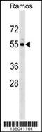 Unc-5 Family C-Terminal Like antibody, 59-753, ProSci, Western Blot image 