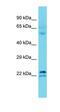 Transmembrane Protein 182 antibody, orb326866, Biorbyt, Western Blot image 