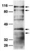 ADAM Metallopeptidase Domain 19 antibody, TA352953L, Origene, Western Blot image 