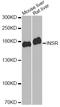 Insulin Receptor antibody, STJ24213, St John