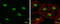 Poly(ADP-Ribose) Polymerase 1 antibody, GTX112839, GeneTex, Immunocytochemistry image 