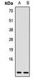 C-C Motif Chemokine Ligand 17 antibody, LS-C668048, Lifespan Biosciences, Western Blot image 