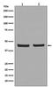 Egl-9 Family Hypoxia Inducible Factor 2 antibody, M03015, Boster Biological Technology, Western Blot image 