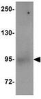 Zinc Finger BED-Type Containing 1 antibody, GTX31375, GeneTex, Western Blot image 