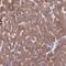 Fatty Acid Desaturase 1 antibody, HPA042705, Atlas Antibodies, Immunohistochemistry paraffin image 