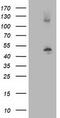 Tubulin Beta 4A Class IVa antibody, CF502962, Origene, Western Blot image 