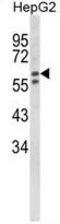 Hexosaminidase Subunit Alpha antibody, GTX81637, GeneTex, Western Blot image 