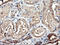 Tubulin Alpha Like 3 antibody, LS-C173524, Lifespan Biosciences, Immunohistochemistry paraffin image 