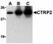 C1q And TNF Related 2 antibody, orb74683, Biorbyt, Western Blot image 