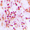Cleavage Stimulation Factor Subunit 1 antibody, LS-C353950, Lifespan Biosciences, Immunohistochemistry paraffin image 