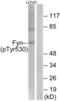 FYN Proto-Oncogene, Src Family Tyrosine Kinase antibody, abx012429, Abbexa, Western Blot image 