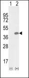 Oxidized Low Density Lipoprotein Receptor 1 antibody, 63-669, ProSci, Western Blot image 