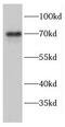 Ectonucleoside Triphosphate Diphosphohydrolase 4 antibody, FNab02784, FineTest, Western Blot image 