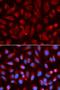 Adenosine Deaminase antibody, orb129504, Biorbyt, Immunofluorescence image 