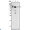 MDM4 Regulator Of P53 antibody, LS-C812695, Lifespan Biosciences, Western Blot image 