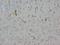Neurofilament Heavy antibody, LS-C171217, Lifespan Biosciences, Immunohistochemistry paraffin image 